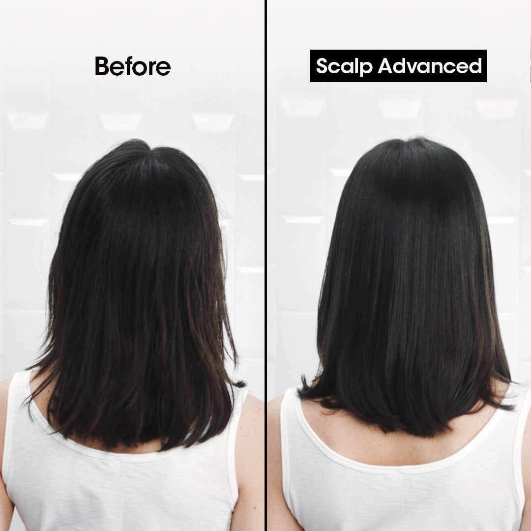 L'Oreal Professionnel Scalp Advance Anti Dandruff Shampoo 300ml