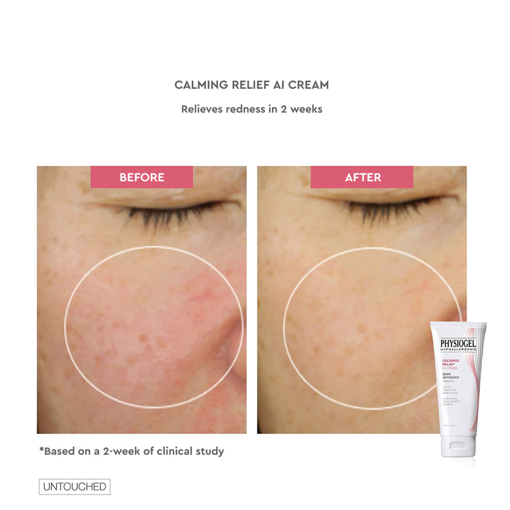 Physiogel Irritated Skin Calming Relief A.I. Cream 50ml