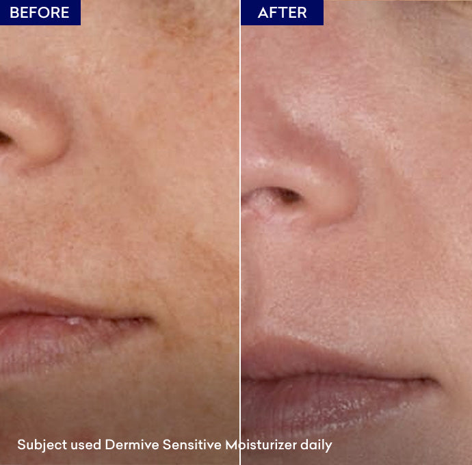 Jenpharm Dermive Sensitive Moisturizer