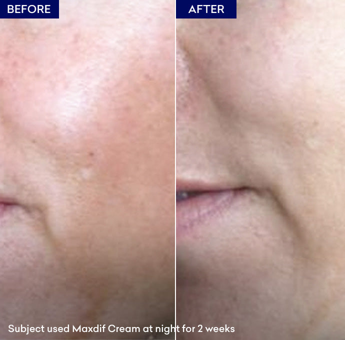 Jenpharm Maxdif Brightening Cream