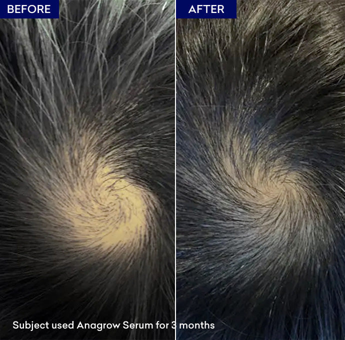 Jenpharm Anagrow Hair Serum 50ml