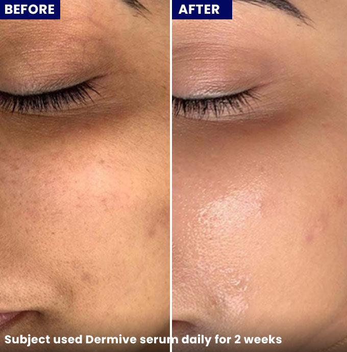 Jenpharm Dermive Hyaluronic Acid Serum 30ml