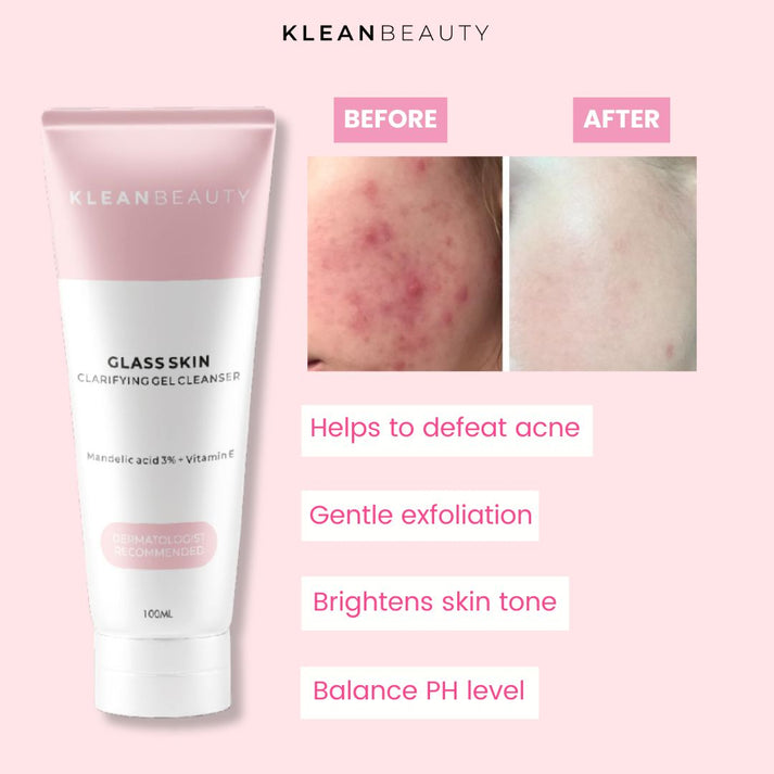 Klean Beauty Clarifying Gel Cleanser Facewash 50ml
