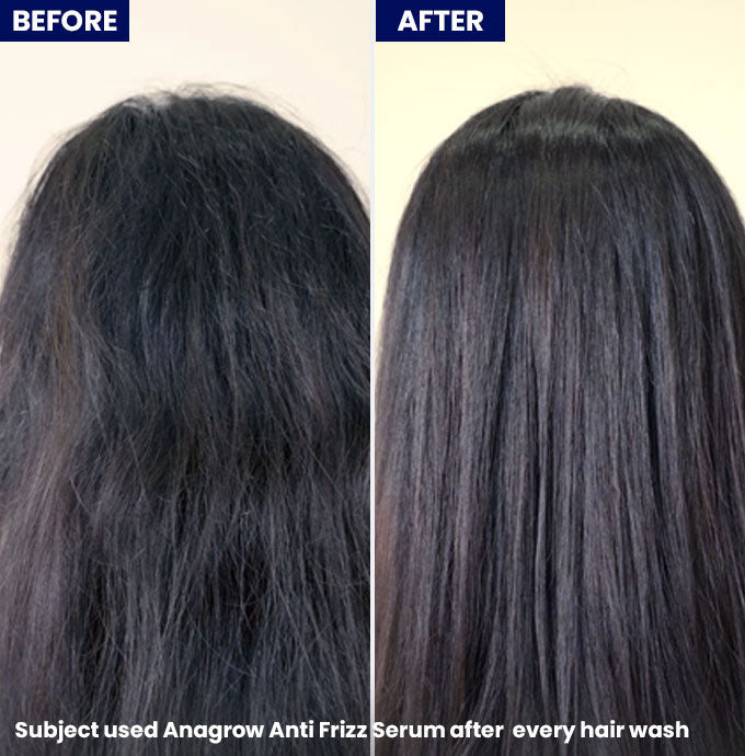Jenpharm Anagrow Anti Frizz Hair Serum 50ml
