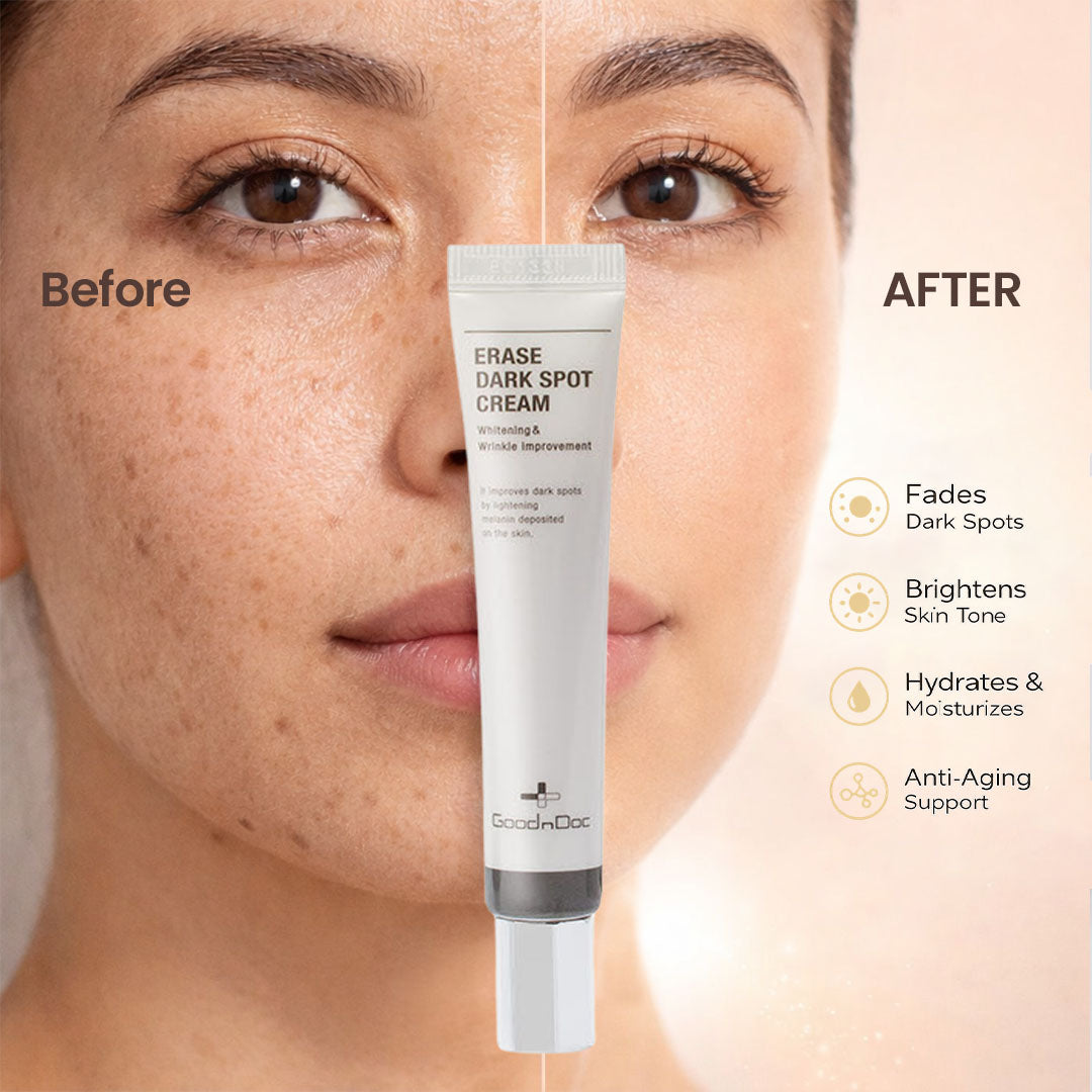 GoodnDoc Erase Dark Spot Cream 20ml*2ea