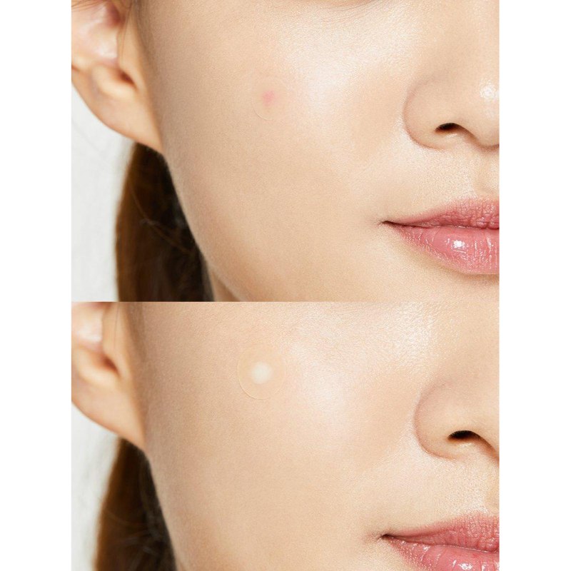 Cosrx Acne Pimple Master Patch 24pcs
